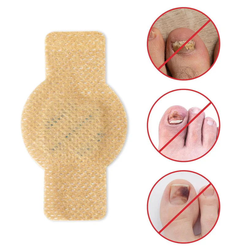 NailHeal™ - Fungal Nail Patches 🌿💅 ( Buy 1 Get 1 Free🔥🔥) - Image 8
