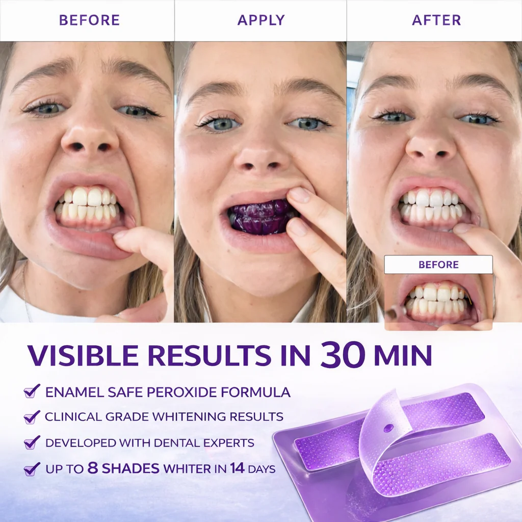 Teeth Whitening Strips (14 Strips Pack) - Image 4